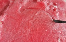 夏日爽口小菜凉拌西瓜皮