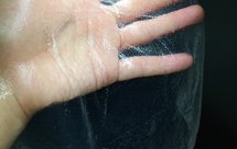 自制拉皮(土豆淀粉或红薯淀粉）